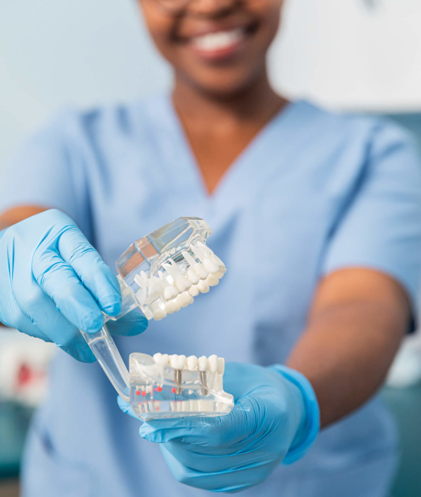Dental Implants in East London