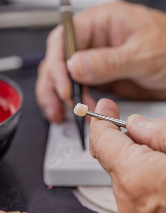 Prosthodontic services