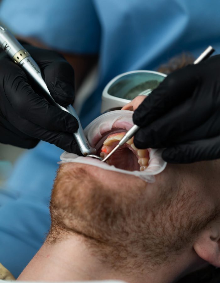 Tooth Whitening Dentist